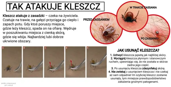 Kleszcz przed i po 12 godzinach żerowania. Widoczny jest jego wygląd po wbiciu w skórę i po tym, jak zaczyna się nasycać krwią.